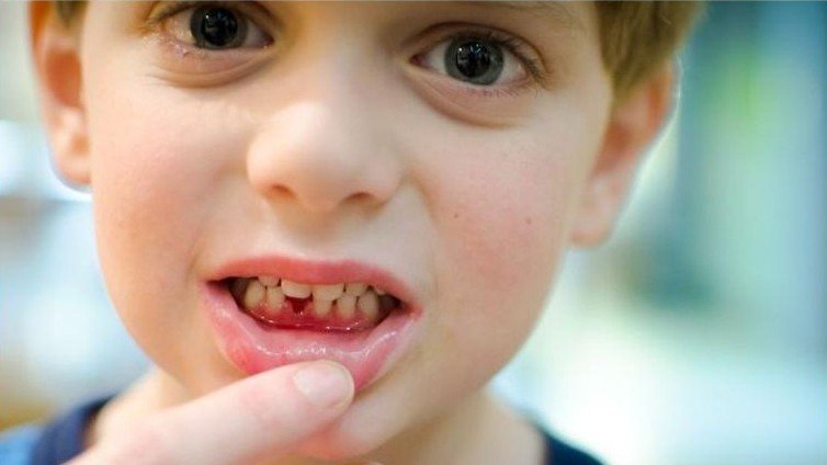 Dental Trauma Management