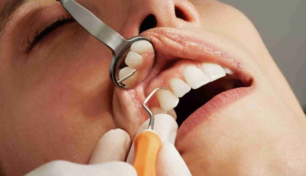 Minor Oral Surgical Procedures